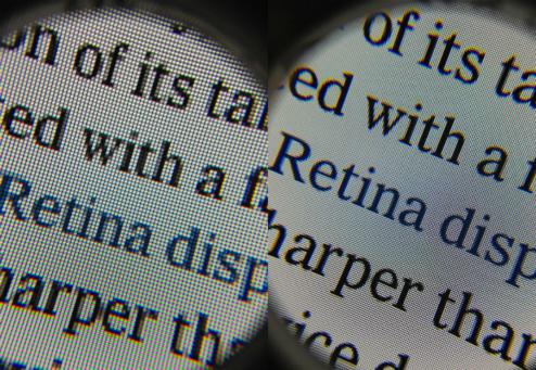 retina1.jpg retina1.jpg